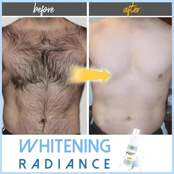 (🔥Summer Hot Sale 50% OFF) Semi-permanent Hair Removal Spray - BUY 4 FREE SHIPPING