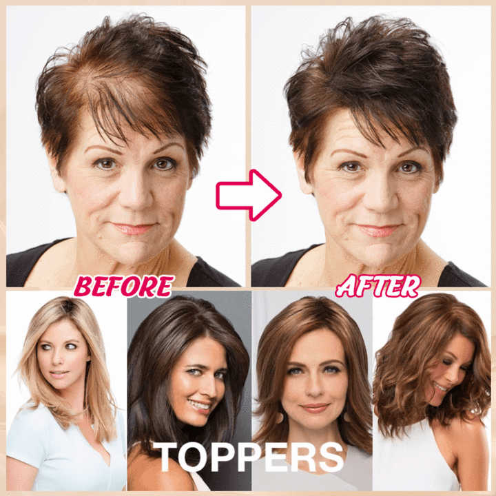2024 HOT SALE🔥 45% OFF|SHORT NATURAL  HAIR TOPPERS